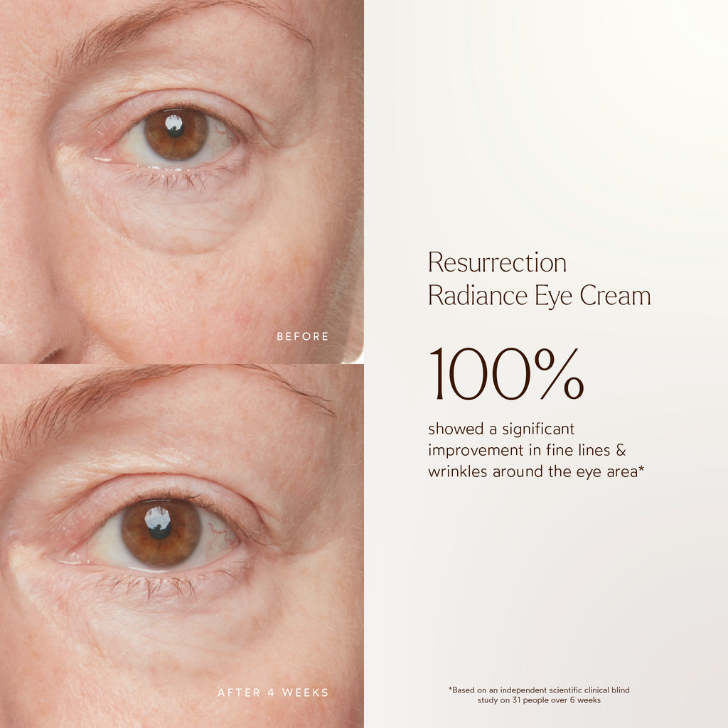 True Botanicals-RENEW Resurrection Radiance Eye Cream-Skincare-S-W-D-RREC-R-3_5704d7d5-c2f4-4467-bcef-3ff7e3c8be2c-The Detox Market | 